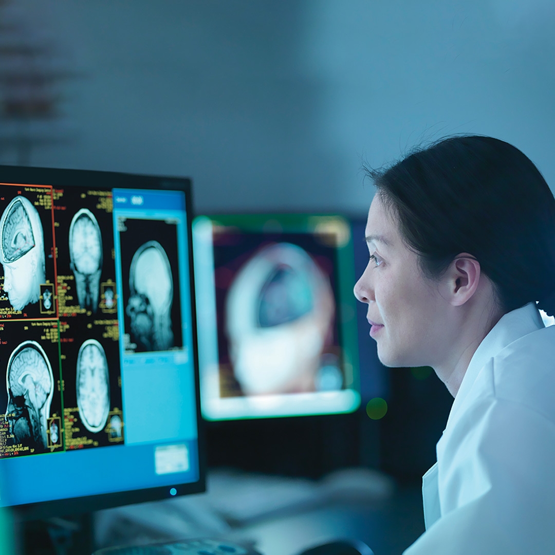 a young female neurologist analyzing brain scans displayed on the screen